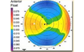 Cornea Diagnostics